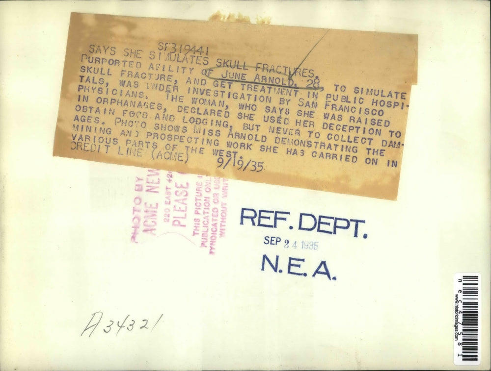 1935 Press Photo June Arnold simulates skull fractures.