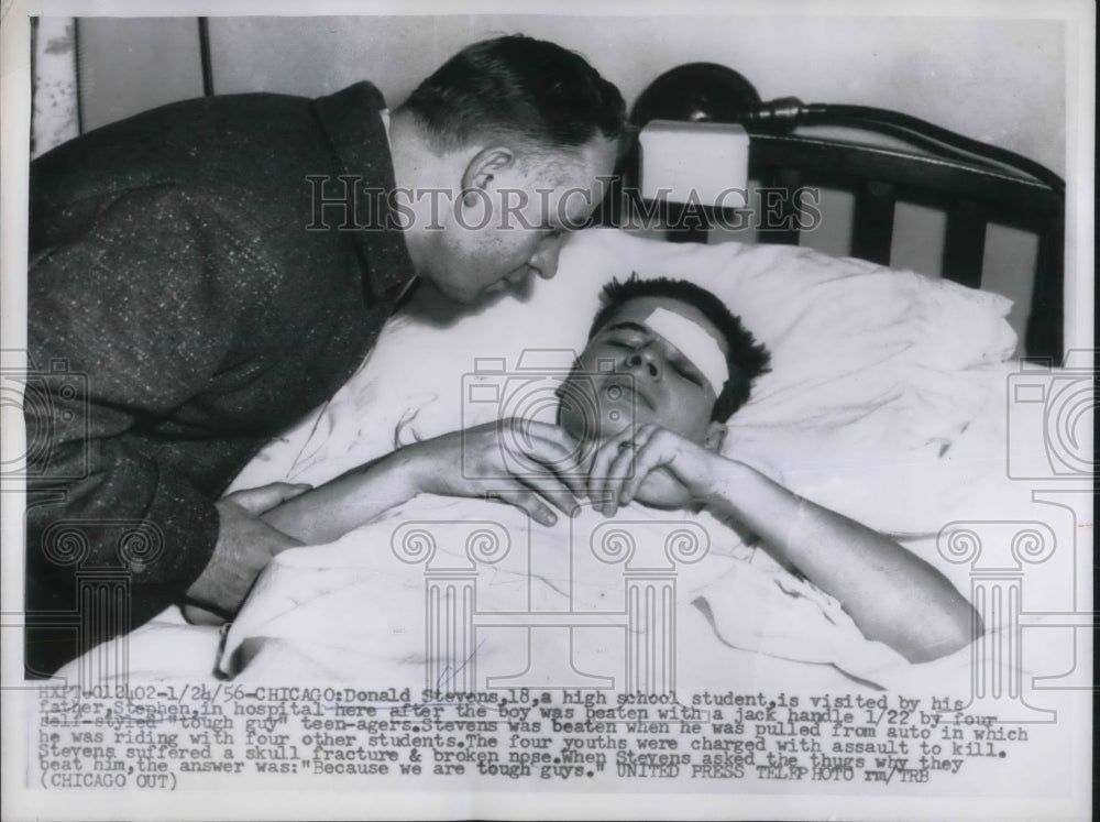 1956 Press Photo Don Stevens was pulled from his car and clubbed by 4 hoods