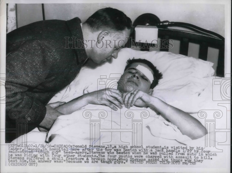 Load image into Gallery viewer, 1956 Press Photo Don Stevens was pulled from his car and clubbed by 4 hoods
