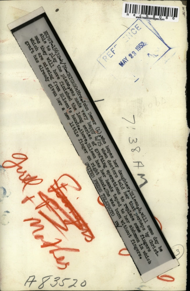 1952 Press Photo Mrs John Dewer With Daughter Eileen Born Without Fingers