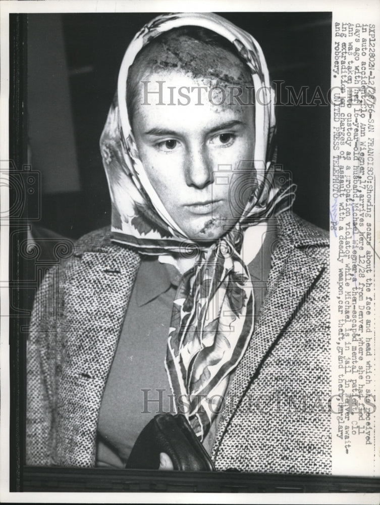 1966 Press Photo San Francisco. Ann Wiegner after being in auto accident