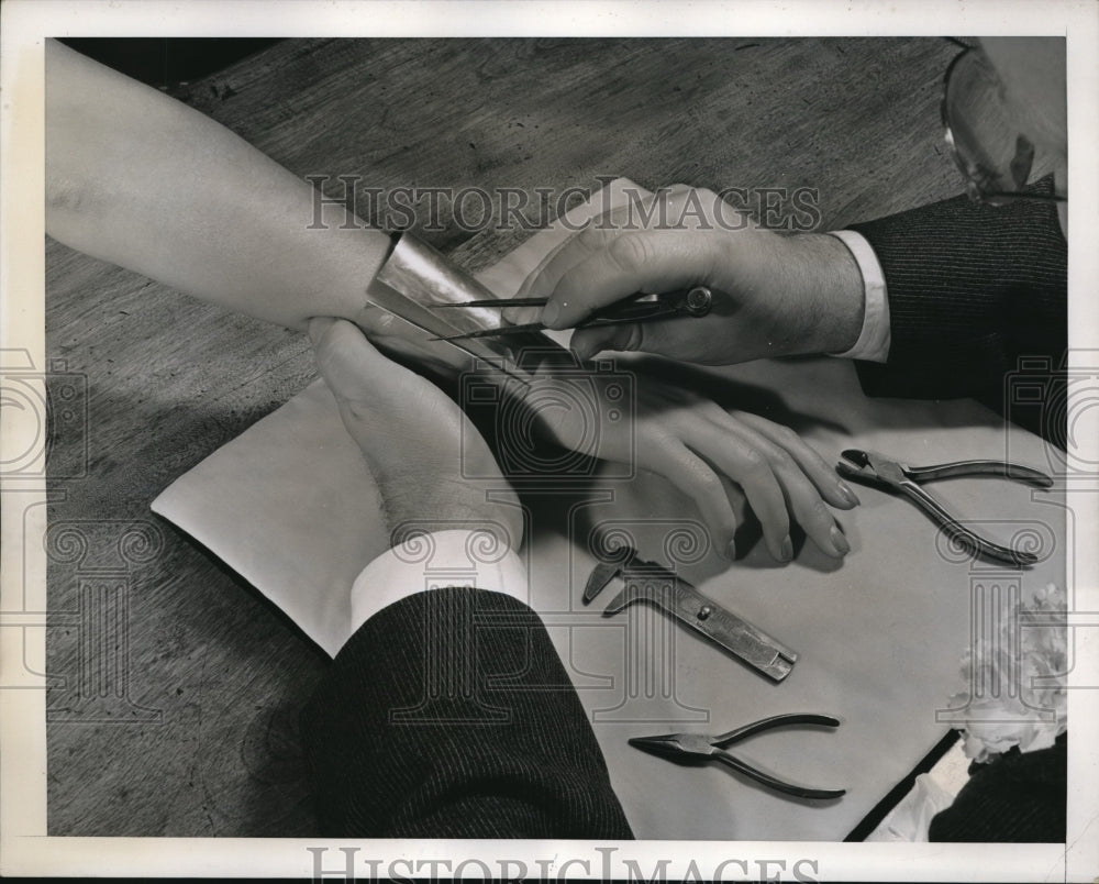 1939 Press Photo LAdy has a plaster cast made of her wrist with tin bracelet