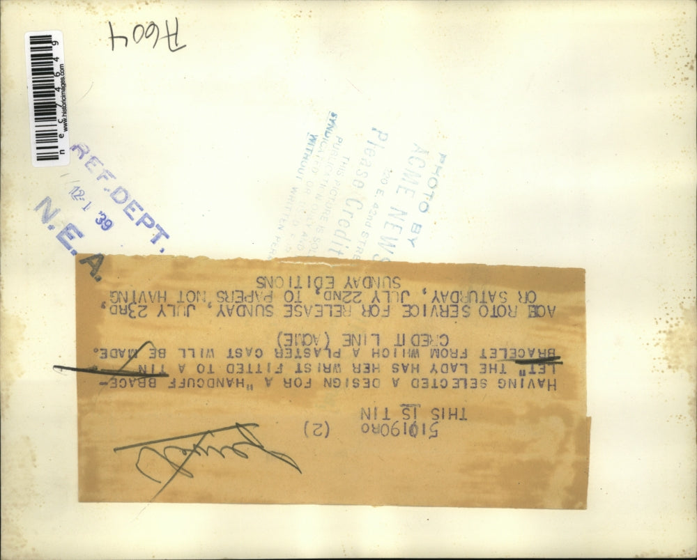 1939 Press Photo LAdy has a plaster cast made of her wrist with tin bracelet