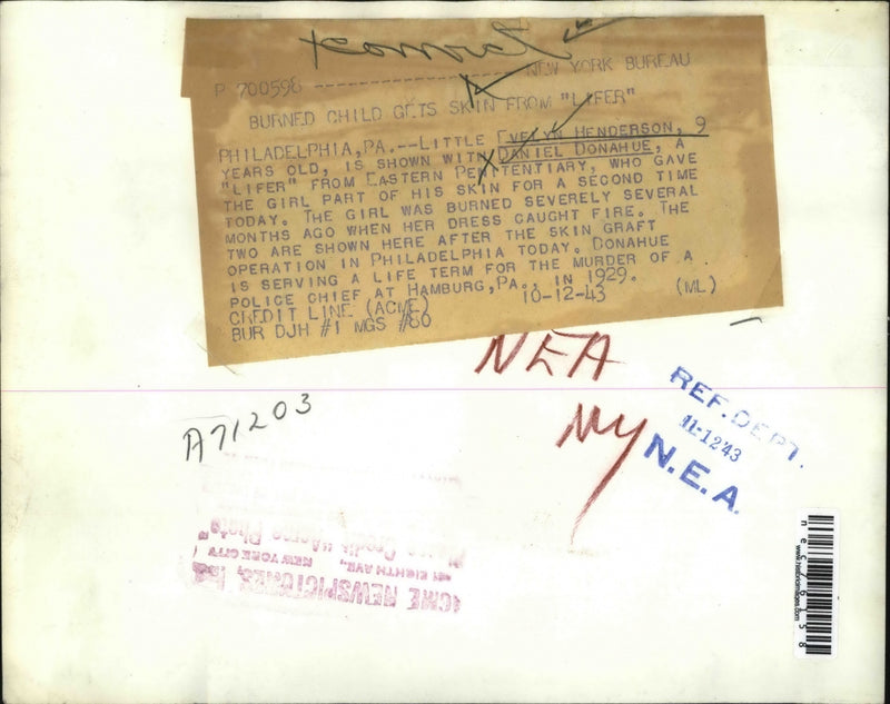 Load image into Gallery viewer, 1943 Press Photo Daniel Donahue a lifer gave part of his skin to burned Child.
