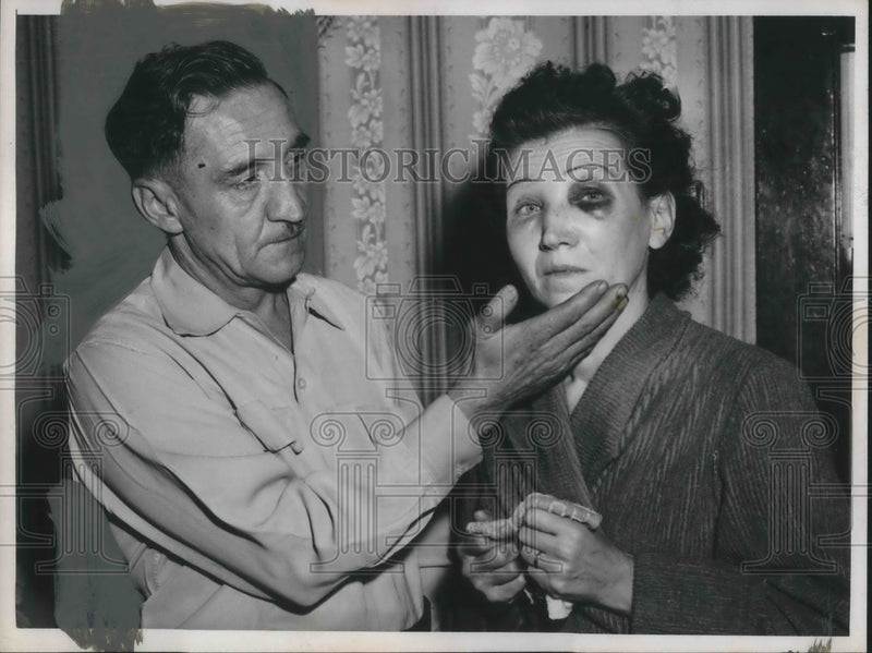 Load image into Gallery viewer, 1955 Press Photo Thomas and Helen Todlack with black eyes

