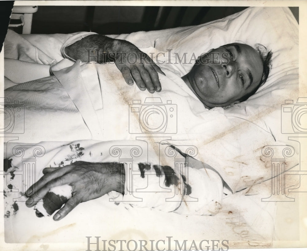 1941 Press Photo John Lubniewski Recovering From Injury- Historic Images