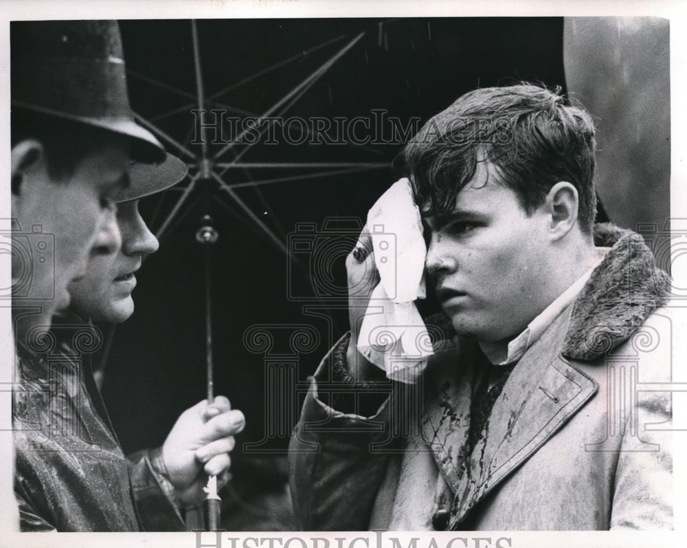 Press Photo Brian Corrigan injured with cut above right eye