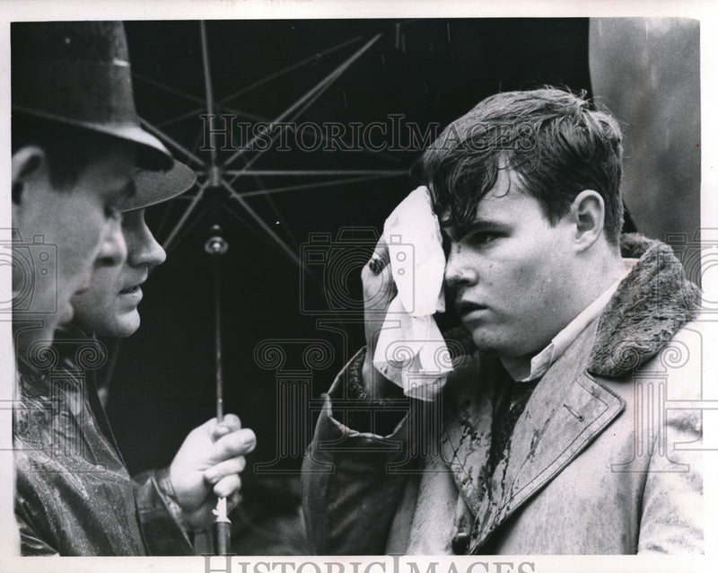 Load image into Gallery viewer, Press Photo Brian Corrigan injured with cut above right eye
