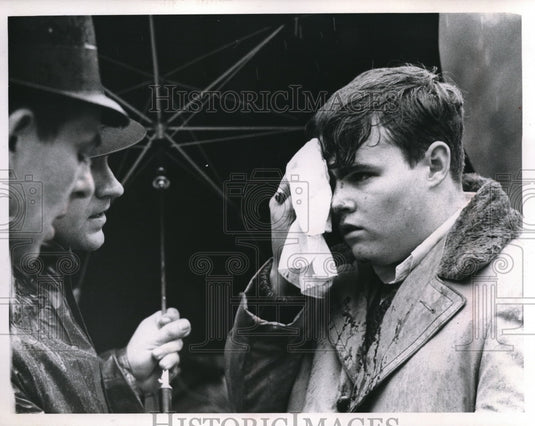 Press Photo Brian Corrigan injured with cut above right eye