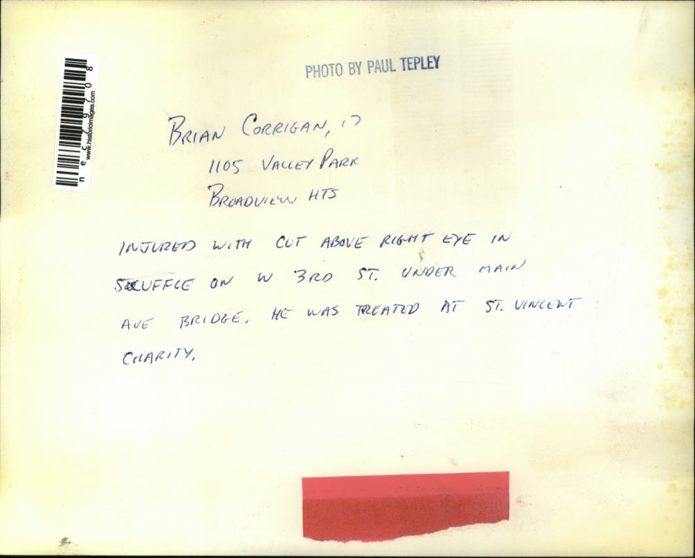 Press Photo Brian Corrigan injured with cut above right eye