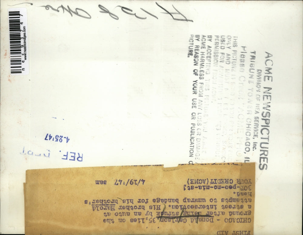 1947 Press Photo Donald Carlson after being struck by an automobile.