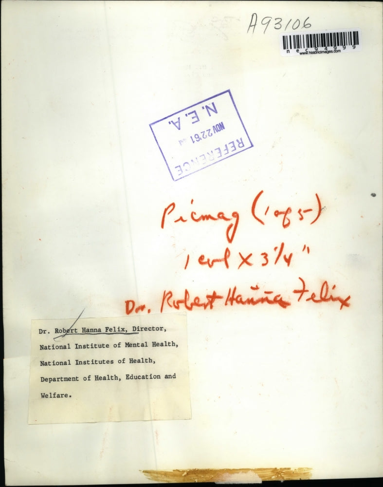 1961 Media Photo Dr. Robert Hanna Felix Director National Institute