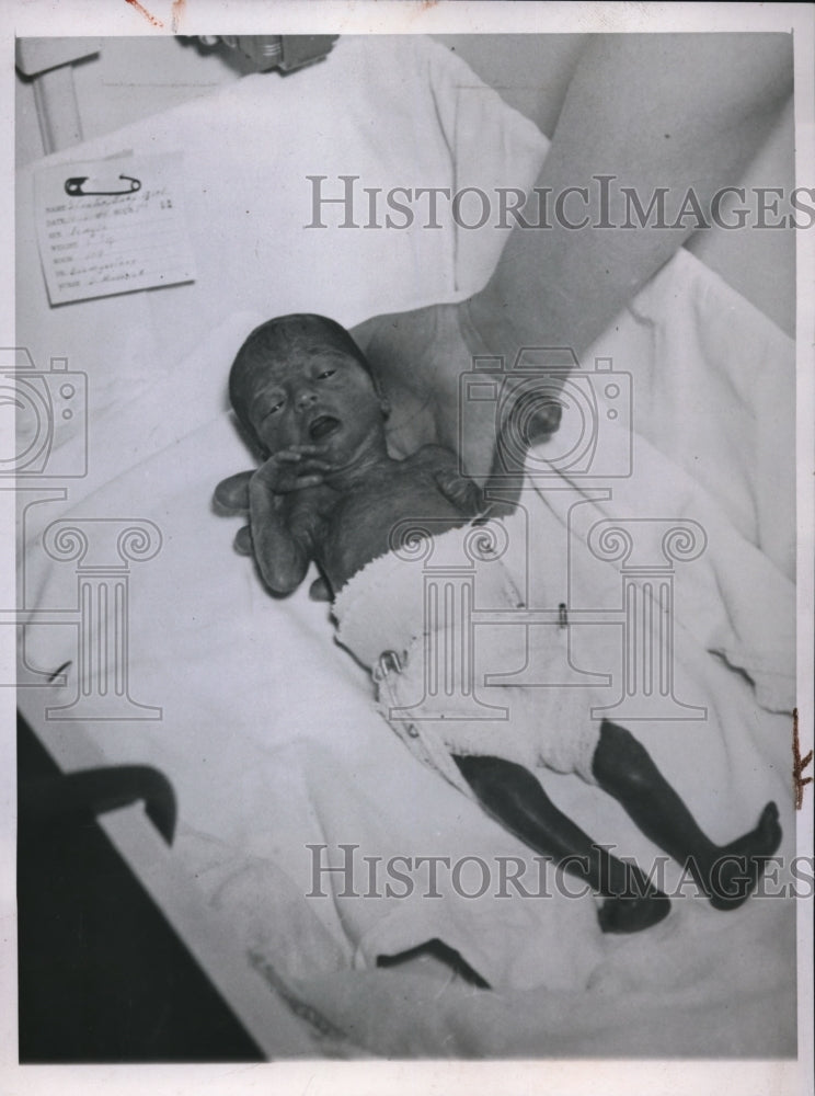 1944 Press Photo Bismarck N Dak baby Stabton weighed 25 ounces at birth