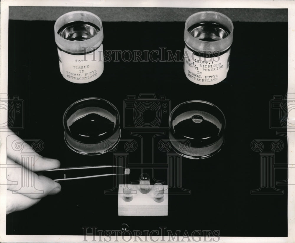 1949 Press Photo Tissue samples preped for microscope at Bureau of Standards