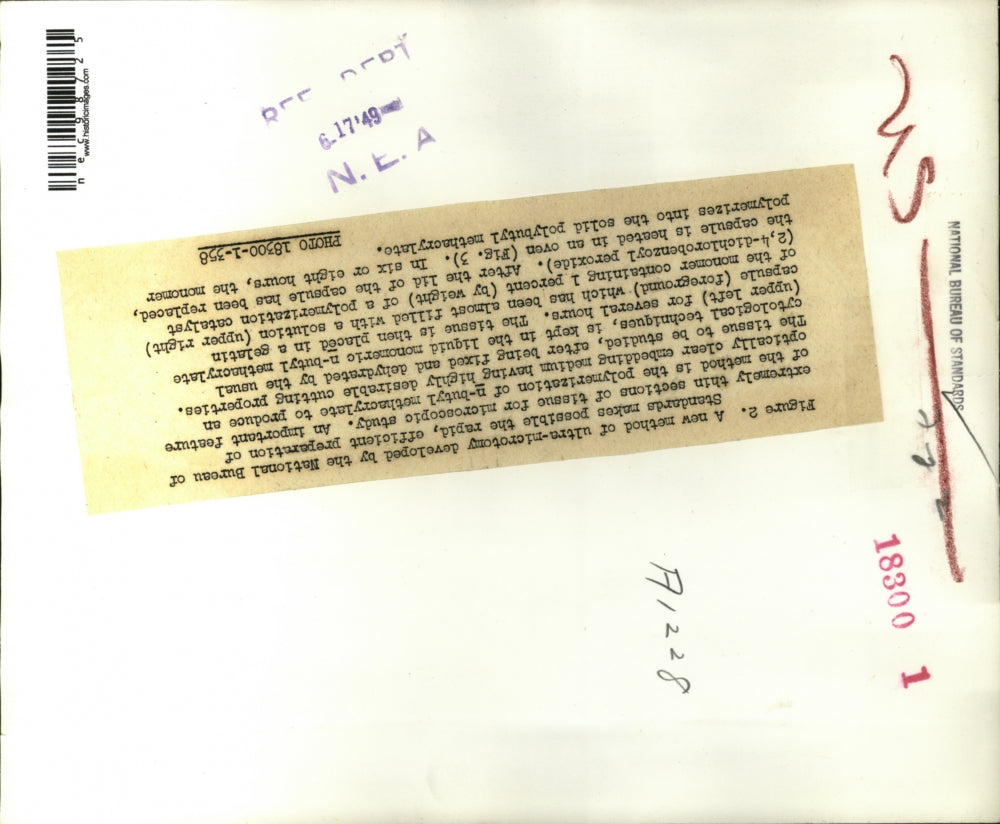 1949 Press Photo Tissue samples preped for microscope at Bureau of Standards