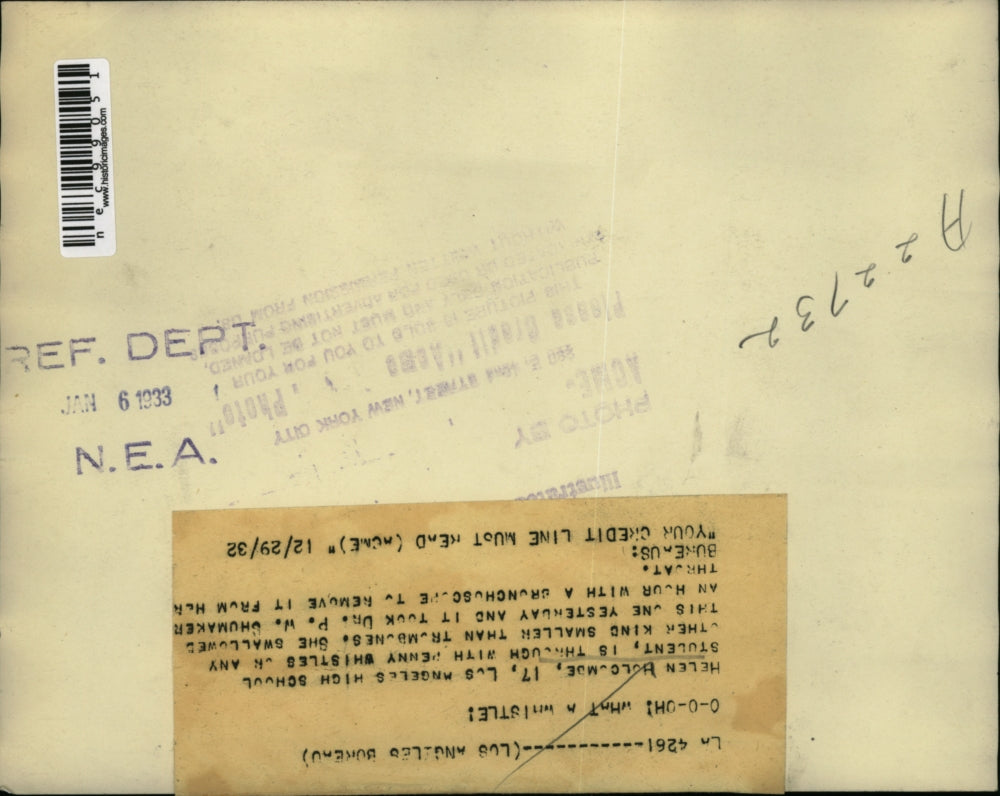 1933 Press Photo Dr. Shumaker removes a penny whistle out of Helen's throat