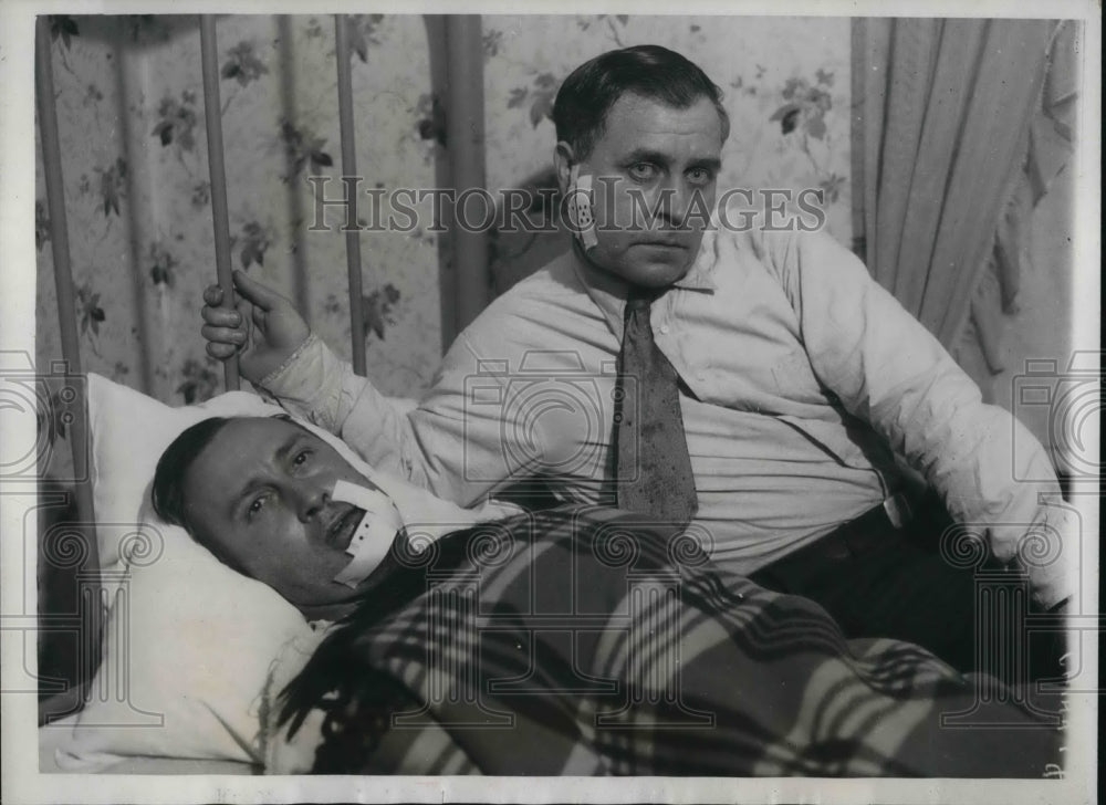 1933 Press Photo James Alderman &amp; his brother Pres John victims of mine war