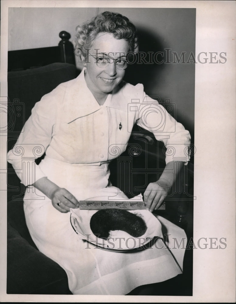1949 Media Photo Woman Observing Hair Clot from Patient's Stomach