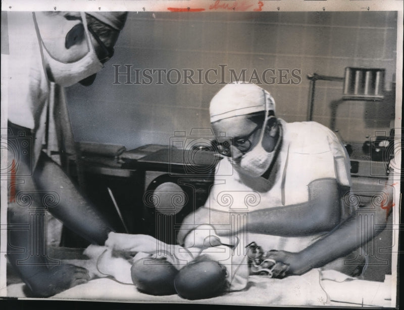 Load image into Gallery viewer, 1956 Media Photo San Diego Cal. Drs separate Siamese twins Hutchens
