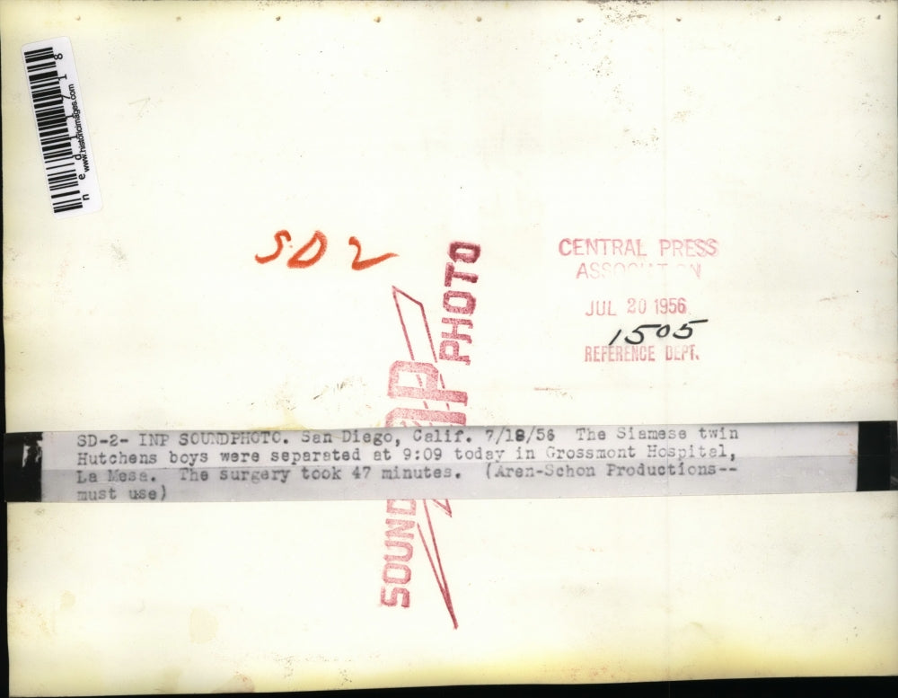 1956 Media Photo San Diego Cal. Drs separate Siamese twins Hutchens