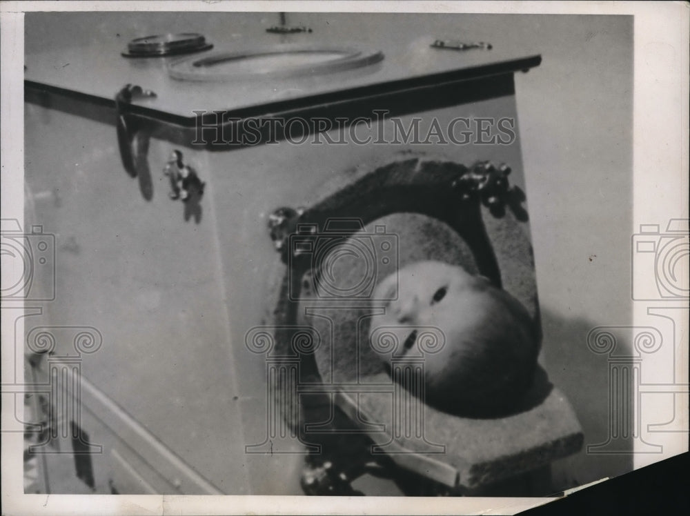 1938 Press Photo Raymond Alexander, Jr., appeared to be stillborn, but is not.