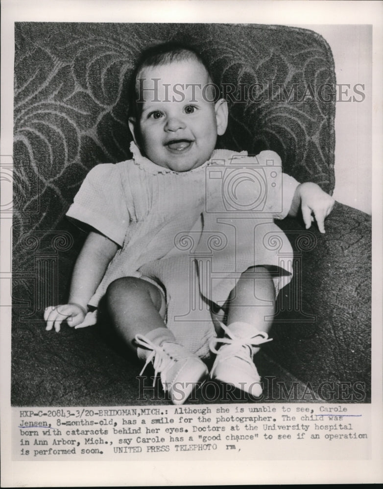 1954 Press Photo Carole Jensen Was Born With Cataracts Behind Her Eyes