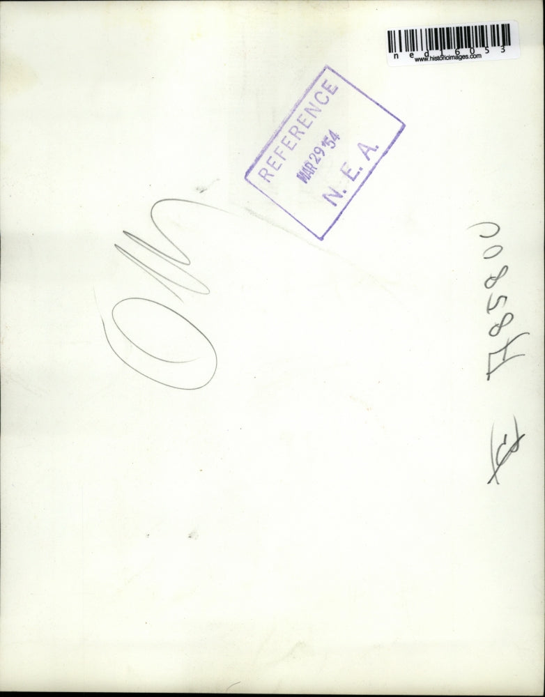 1954 Press Photo Carole Jensen Was Born With Cataracts Behind Her Eyes