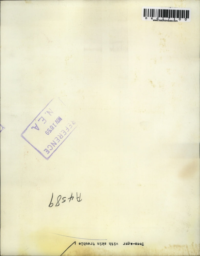 1959 Press Photo A teen ager with skin trouble & acne medicine