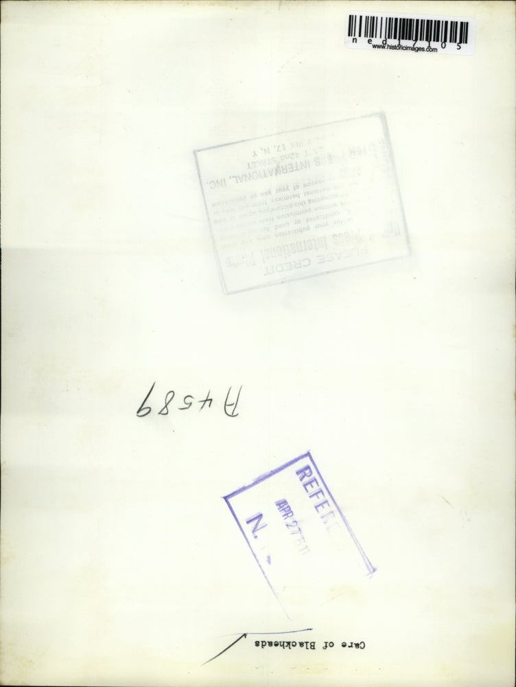 1960 Press Photo A woman appliing lotion to get rid of blackheads