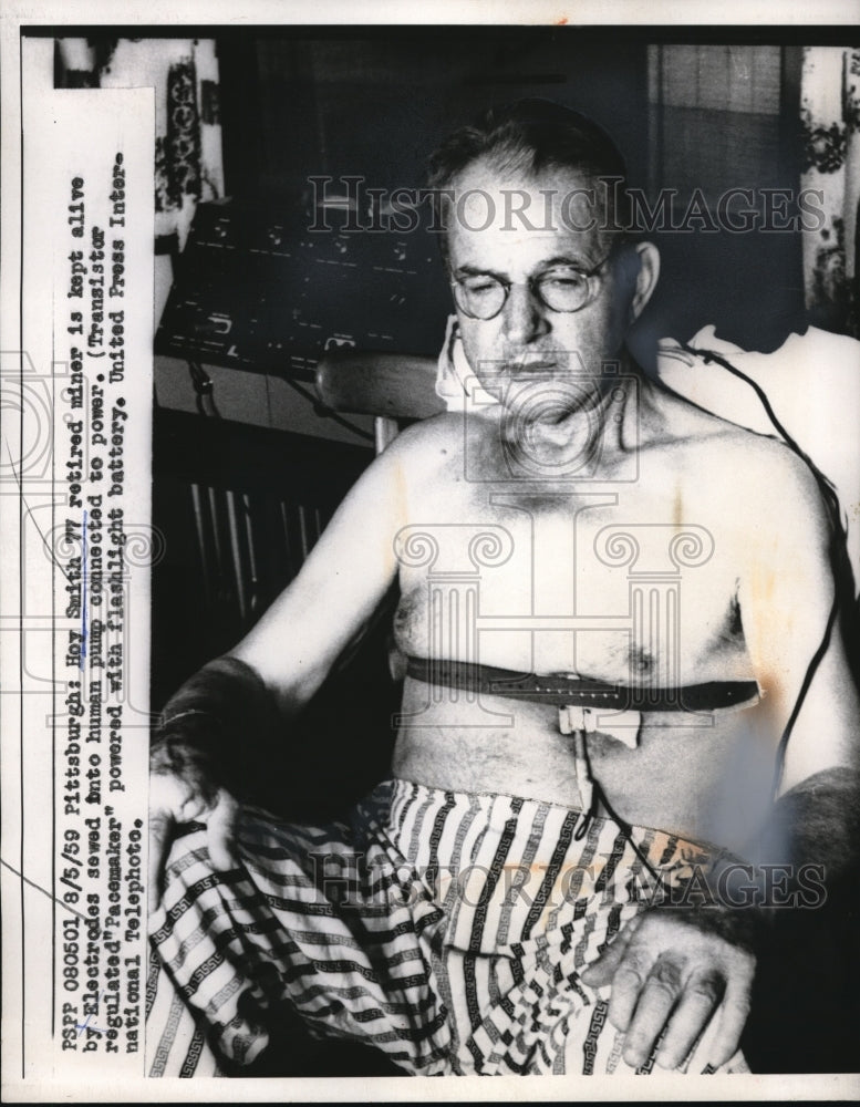 1959 Press Photo Hoy Smith Kept Alive By Electrodes into Human Pump