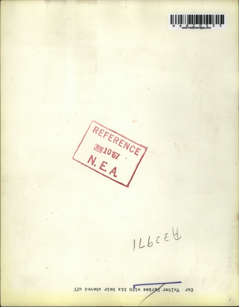 1957 Press Photo Walter Parkes With Hair Shaved Off