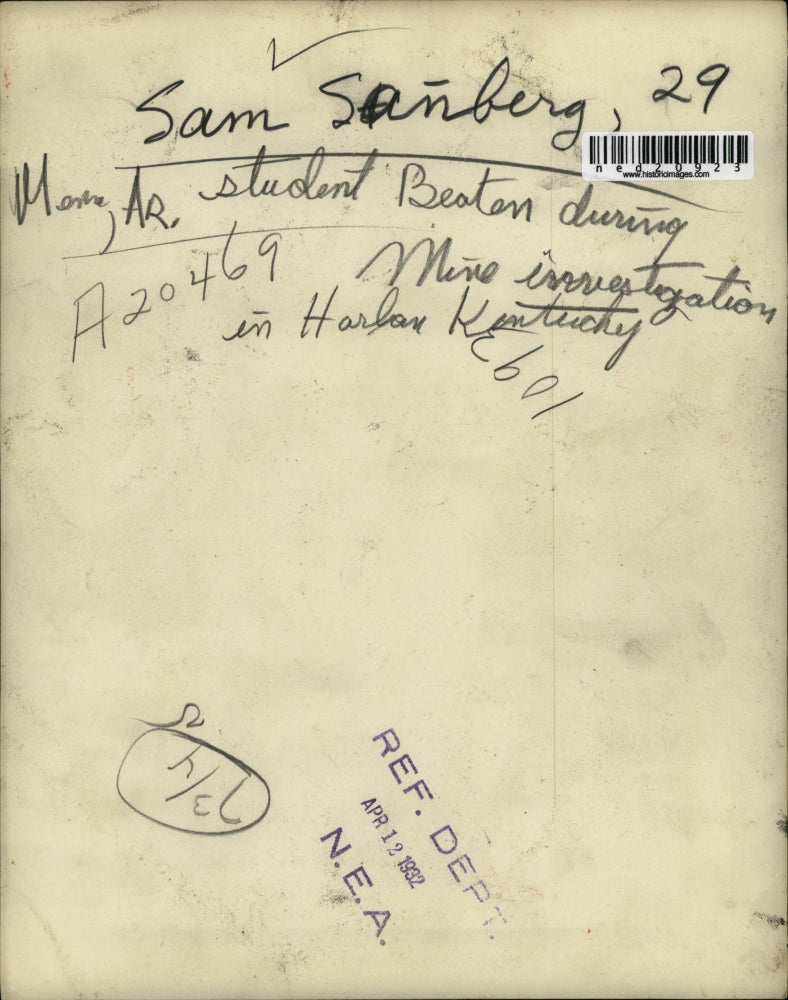 1932 Press Photo Sam Sandberg Student Beaten During Mine Investigation