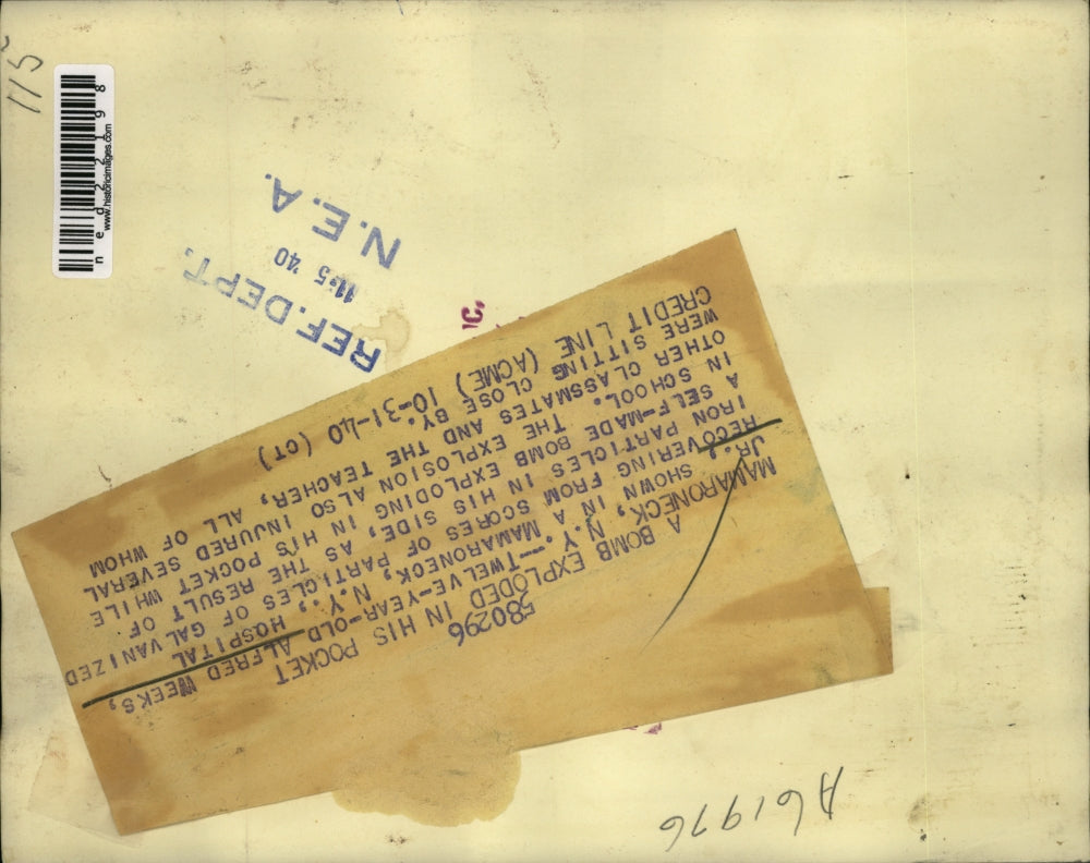 1940 Press Photo Mamaroneck NY Alfred Weeks Jr age 12 hurt with self made bomb