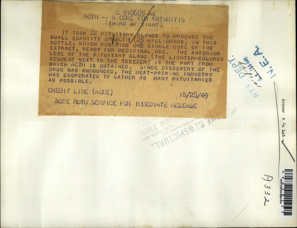 1949 Press Photo vial of ACTH and anterior lobe of pituitary glands