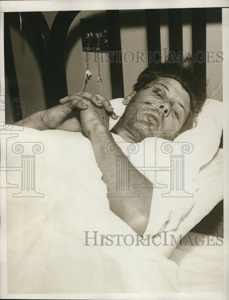 1934 Press Photo Injured in La Crescenta flood