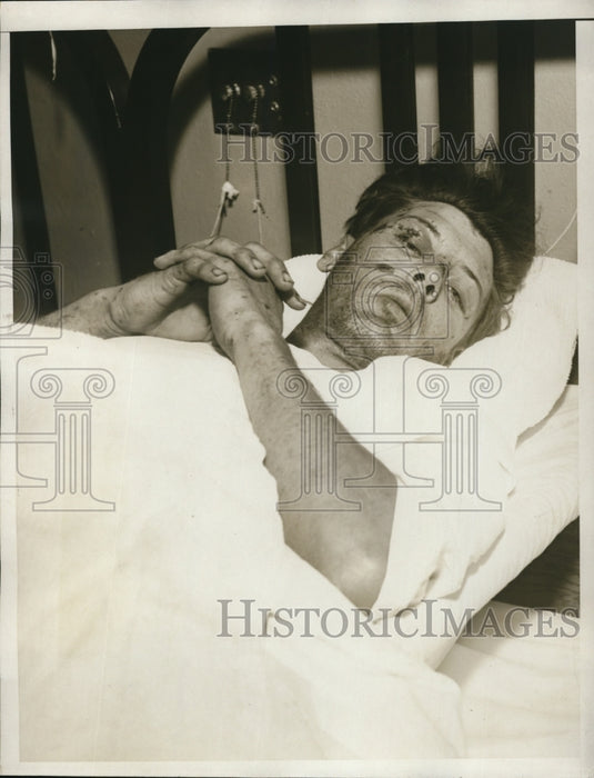 1934 Press Photo Injured in La Crescenta flood