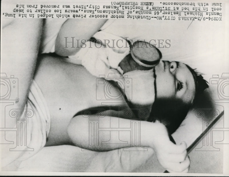Load image into Gallery viewer, 1947 Press Photo Dennis Michael Healzer wears ice collar at St. Luke's Hospital
