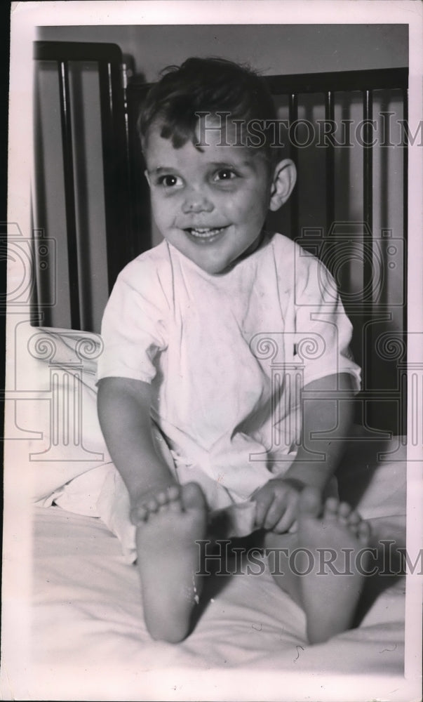1950 Press Photo Robert Van Orman still smiles despite of bruises - ned35972