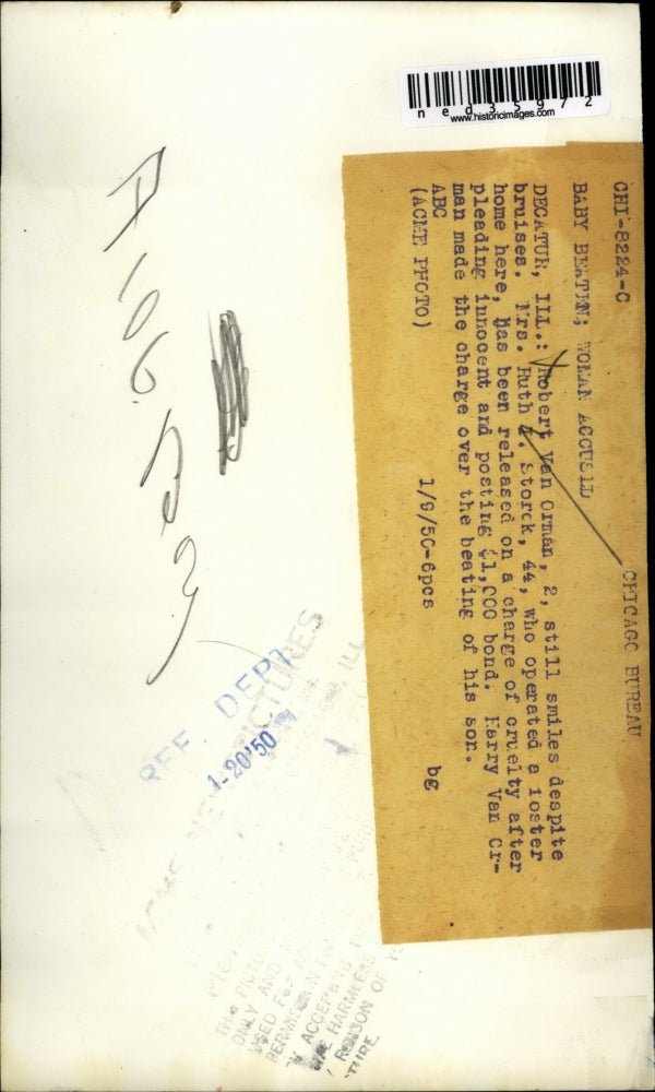 1950 Press Photo Robert Van Orman still smiles despite of bruises - ned35972