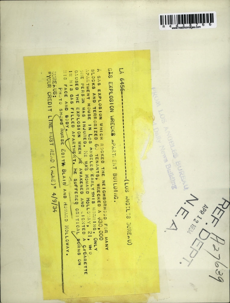 1934 Press Photo A nurse tending to Howard Holloway who lit a cigarette in his