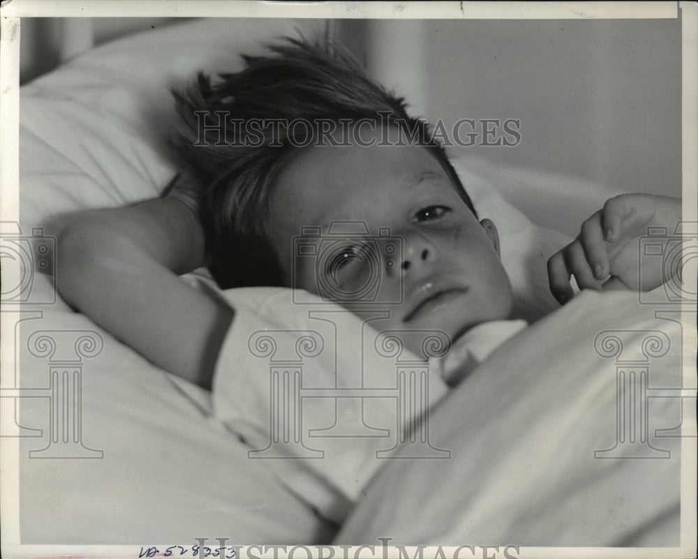 1939 Press Photo Bruce Crozier in the hospital after he was rescued