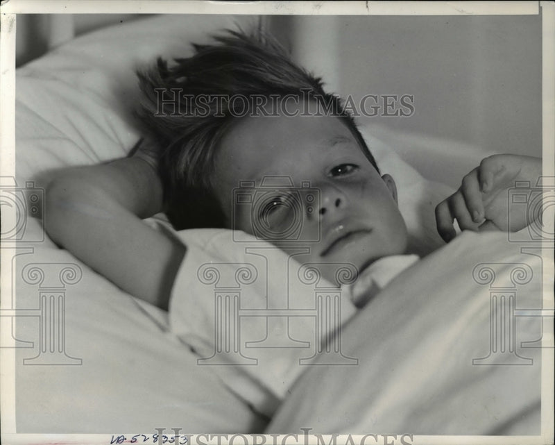 Load image into Gallery viewer, 1939 Press Photo Bruce Crozier in the hospital after he was rescued

