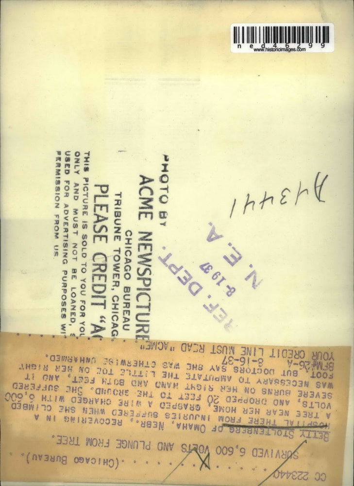 1937 Press Photo Betty Stoltenberg, recovering from hospital from injuries