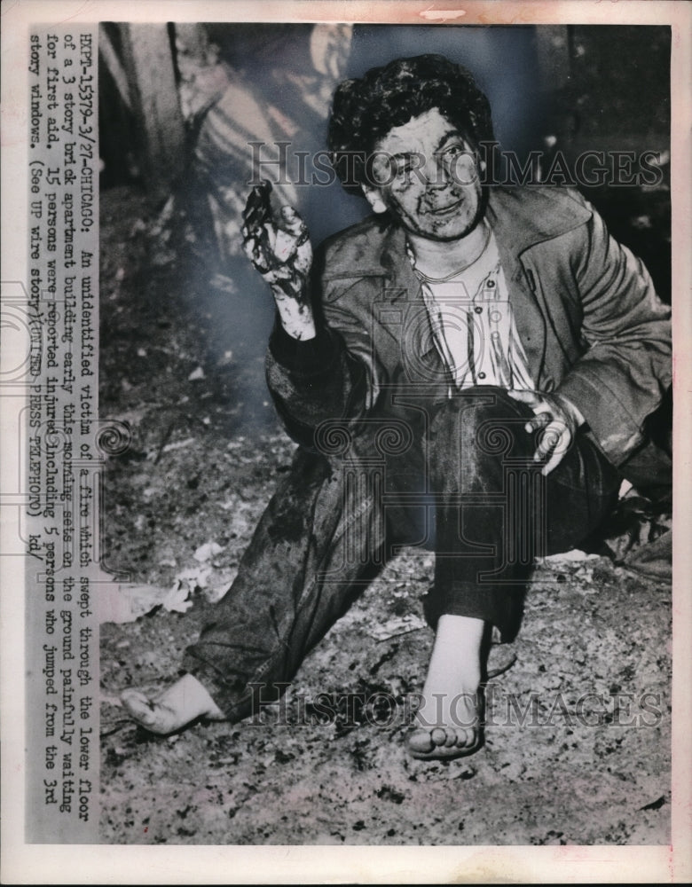 1952 Press Photo An unidentified fire victim painfully awaits for the first aid