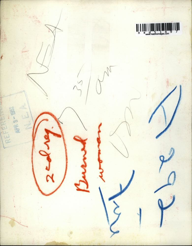 1952 Press Photo An unidentified fire victim painfully awaits for the first aid