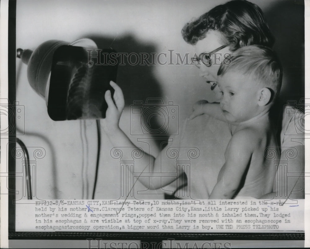 1954 Press Photo Larry Teters not interested in x-ray, with Mrs Clarence Teters