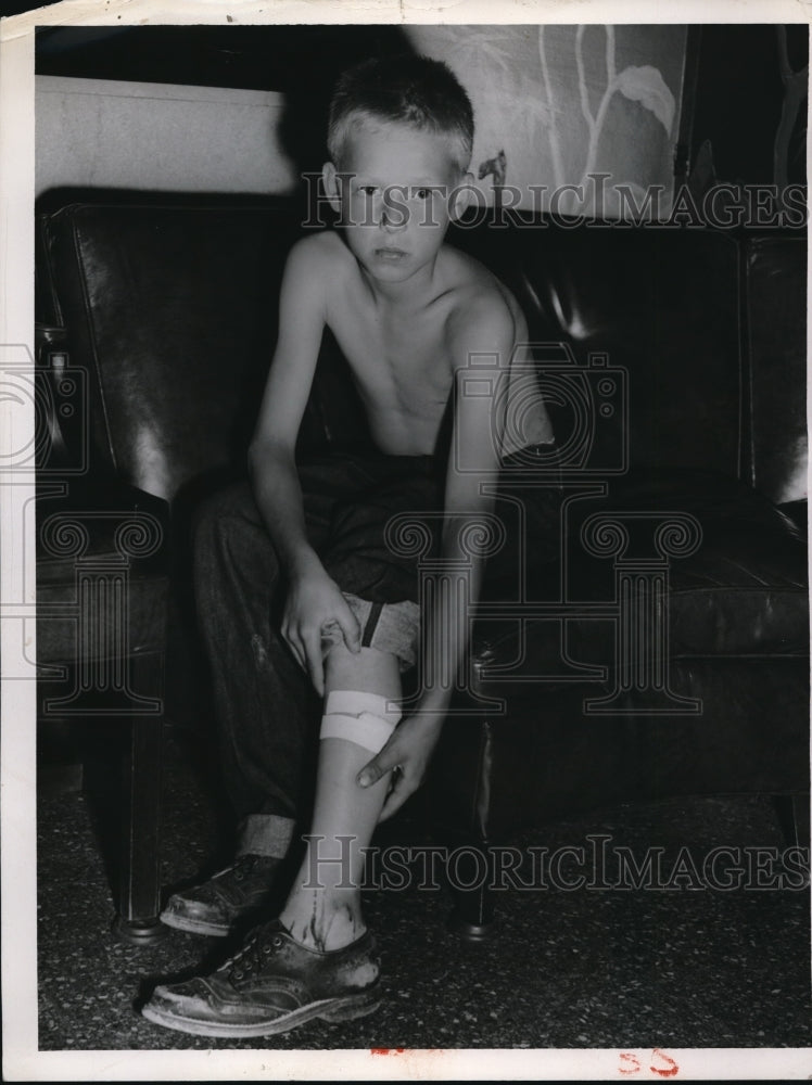 Load image into Gallery viewer, 1953 Press Photo Russel Jr's leg is bleeding when brought to the hospital

