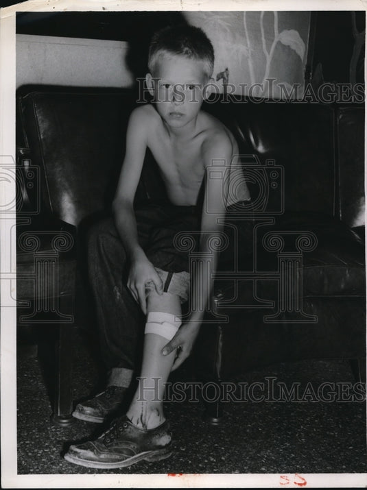 1953 Press Photo Russel Jr's leg is bleeding when brought to the hospital