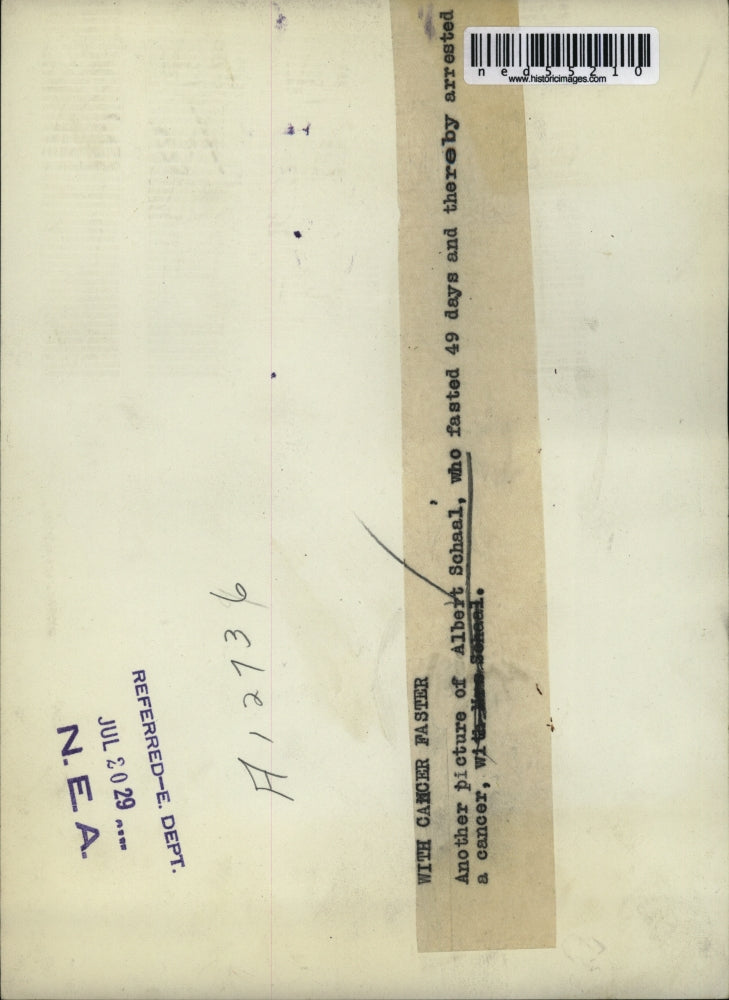 1929 Press Photo Albert Schaal, a man who fasted for 49 days