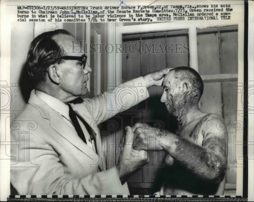 1959 Press Photo Wash DC Horace Green & acid burns with Sen JL McClellan